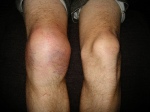 Chris' knees